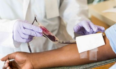 Breakthrough in sickle cell treatment